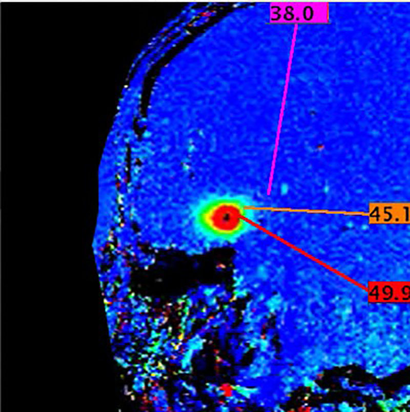 MN Epilepsy Group Focused expertise. Comprehensive care.